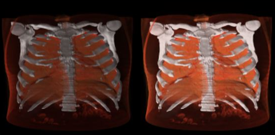 Sante DICOM Editor